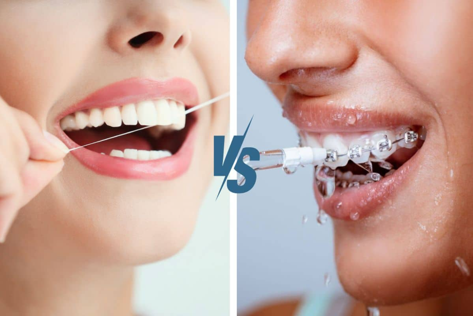 Water Flosser vs Floss for Dental Bridges: What Actually Works