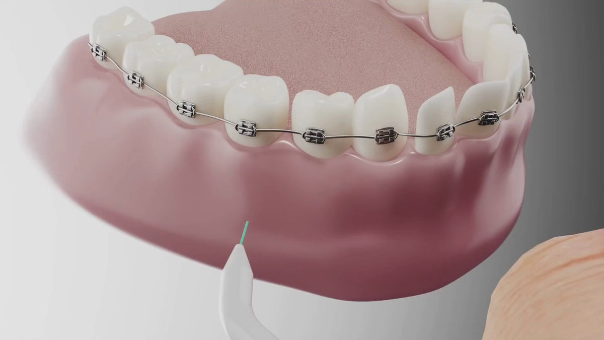 The AutoFlosser. Easy Flossing for Bridges, Implants & Braces